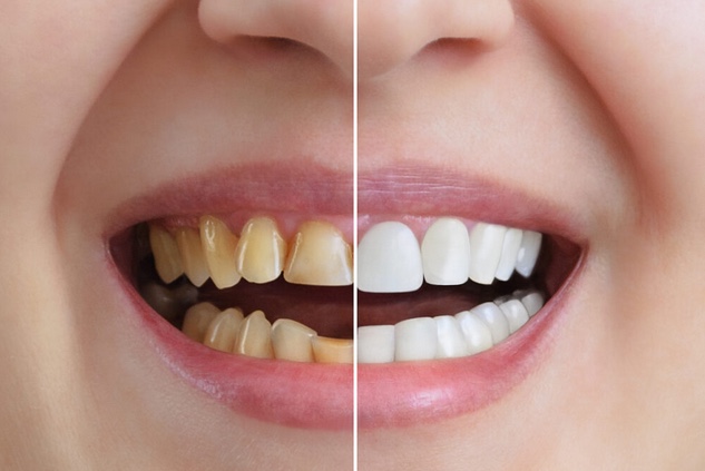 Cosmetic Dentist near me